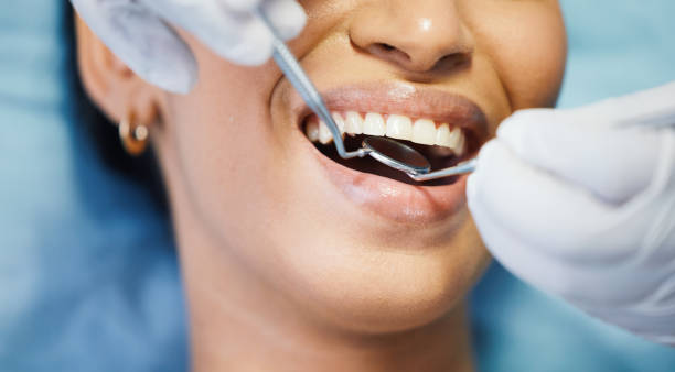 Best Emergency Denture Repair in Belvedere, CA
