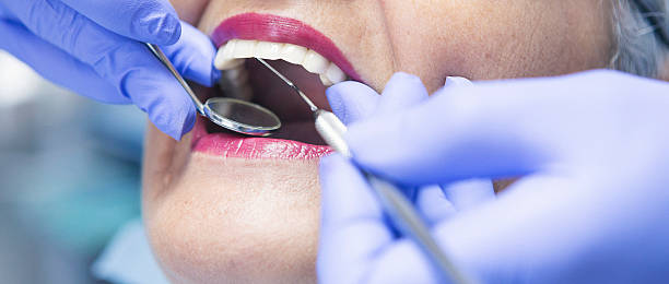 Best Emergency Tooth Extraction in Belvedere, CA